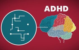 درمان بیماری ADHD با این هدبند