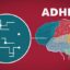 درمان بیماری ADHD با این هدبند