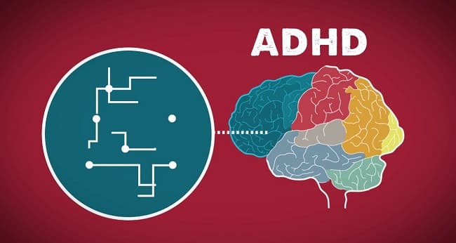 درمان بیماری ADHD با این هدبند